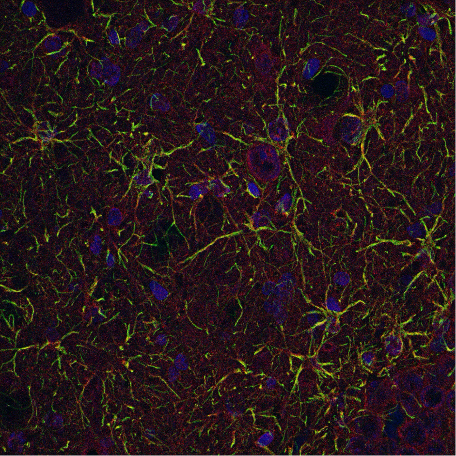 Astrocytic expression of PAI-1