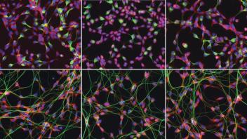 G04 Site 5 Triple Overlay: Human cortical astrocytes immunostained for GFAP (green), NF-kB (red), and DAPI (blue).