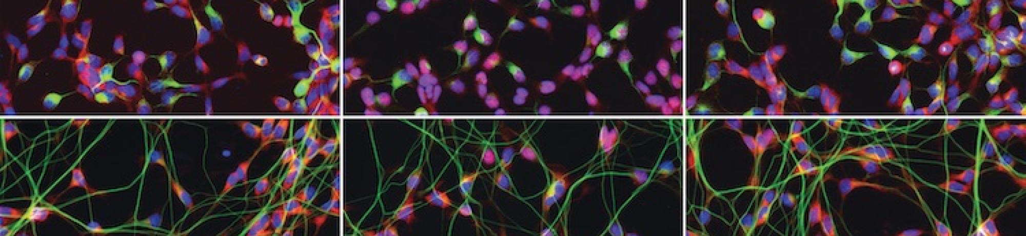 G04 Site 5 Triple Overlay: Human cortical astrocytes immunostained for GFAP (green), NF-kB (red), and DAPI (blue).