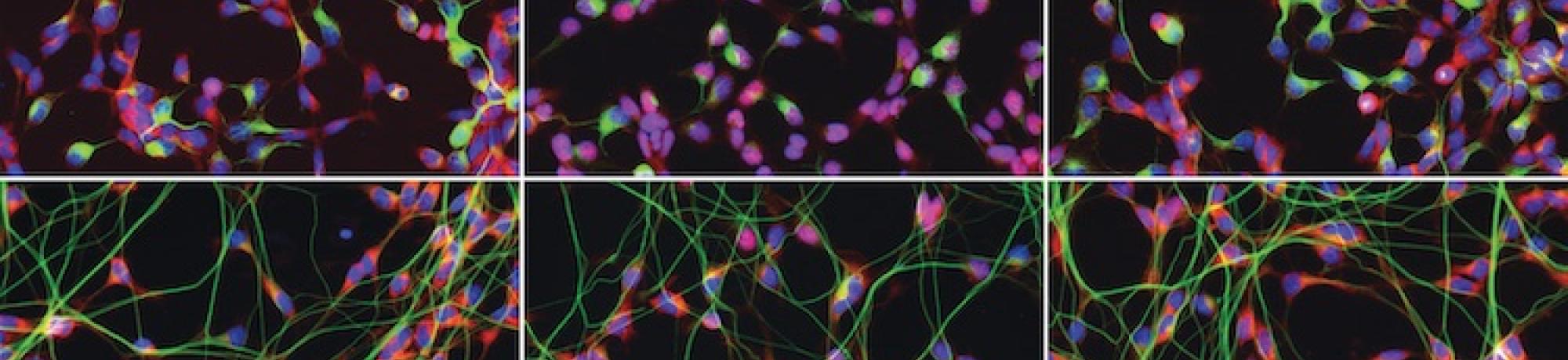 G04 Site 5 Triple Overlay: Human cortical astrocytes immunostained for GFAP (green), NF-kB (red), and DAPI (blue).